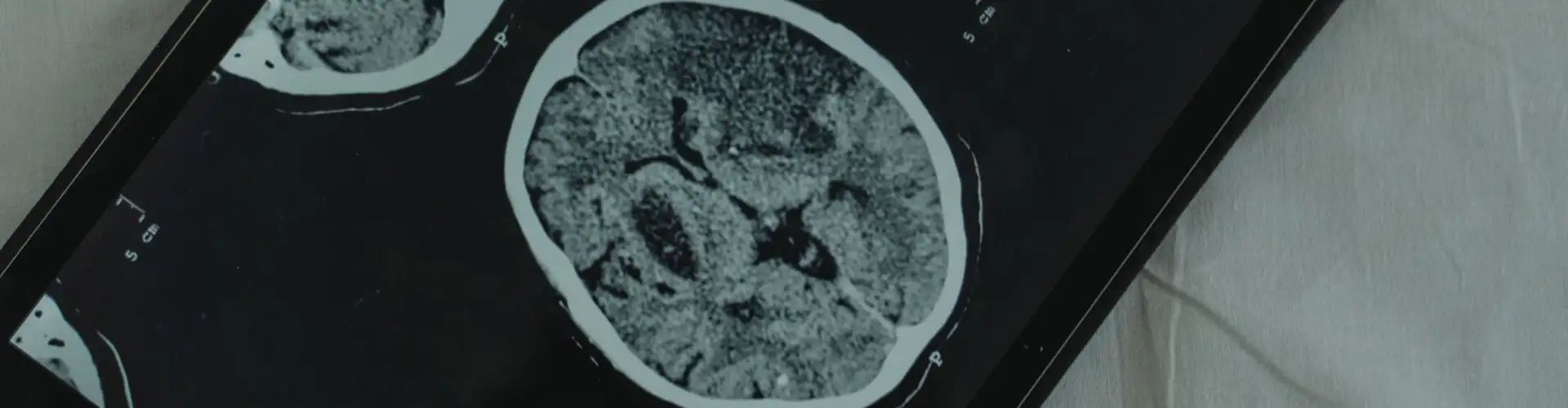 Dopamine: wat het is, wat het doet en de rol bij verslaving